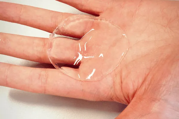 Hydrogels