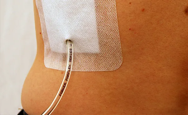 Advanced Wound Care